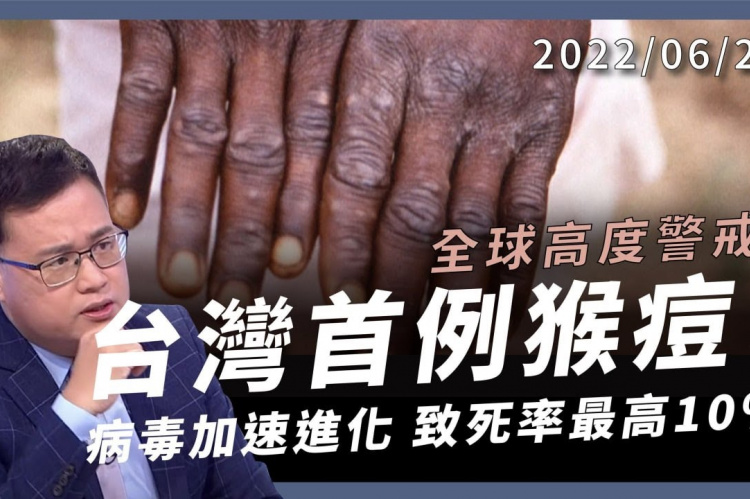 Embedded thumbnail for 台灣首例猴痘！全球高度警戒！